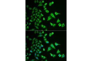 Immunofluorescence (IF) image for anti-Dehydrogenase/reductase (SDR Family) Member 2 (DHRS2) (AA 1-300) antibody (ABIN6139594)