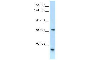 Western Blot showing Rbm15b antibody used at a concentration of 1.