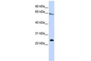 Image no. 1 for anti-Zinc Finger Protein 326 (ZNF326) (N-Term) antibody (ABIN6740648) (ZNF326 antibody  (N-Term))