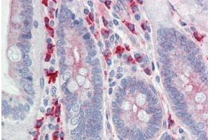 Human Small Intestine: Formalin-Fixed, Paraffin-Embedded (FFPE) (Claudin 6 antibody  (Val118))
