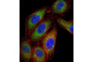 Immunofluorescence (IF) image for anti-Mitogen-Activated Protein Kinase 14 (MAPK14) antibody (ABIN2996778) (MAPK14 antibody)