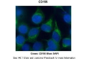 Researcher: Dr. (Poliovirus Receptor antibody  (N-Term))