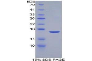 SDS-PAGE analysis of Mouse Corin Protein. (Corin Protein)