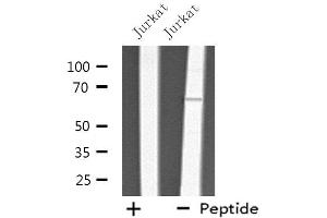 Western blot analysis of extracts from Jurkat cells, using THAS antibody. (TBXAS1 antibody  (N-Term))