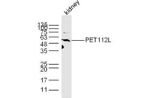 Mouse kidney lysates probed with PET112L Polyclonal Antibody, unconjugated  at 1:300 overnight at 4°C followed by a conjugated secondary antibody at 1:10000 for 60 minutes at 37°C. (PET112L antibody  (AA 101-200))