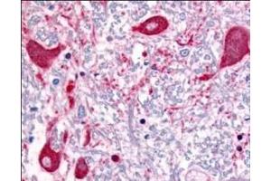 Immunohistochemistry (IHC) image for anti-Roundabout, Axon Guidance Receptor, Homolog 1 (ROBO1) (AA 1625-1650) antibody (ABIN129621)