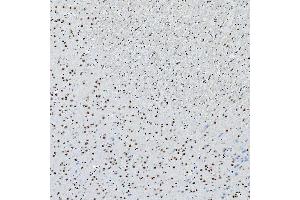 IHC analysis of SNRNP200 using anti-SNRNP200 antibody (ABIN7602032). (SNRNP200 antibody  (AA 557-2129))