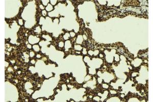 ABIN6276784 at 1/100 staining Mouse lung tissue by IHC-P.
