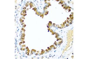 Immunohistochemistry of paraffin-embedded mouse lung using NRG4 antibody (ABIN5971420) at dilution of 1/100 (40x lens). (Neuregulin 4 antibody)