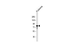 Anti-VTN Antibody (N-term) at 1:32000 dilution + human plasma lysate Lysates/proteins at 20 μg per lane. (Vitronectin antibody  (N-Term))