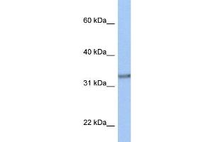 Human MCF-7; WB Suggested Anti-ACBD4 Antibody Titration: 0.