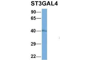 Host:  Rabbit  Target Name:  NOP56  Sample Type:  MCF7  Antibody Dilution:  1. (ST3GAL4 antibody  (Middle Region))