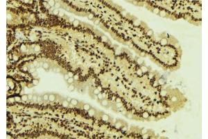 ABIN6277787 at 1/100 staining Mouse colon tissue by IHC-P.
