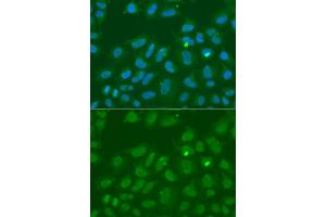 Immunofluorescence analysis of A549 cells using ORC6 antibody (ABIN5973151). (ORC6 antibody)