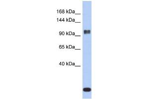 WB Suggested Anti-ATXN7 Antibody Titration: 0. (ATXN7 antibody  (Middle Region))