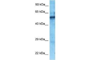 Host:  Rabbit  Target Name:  ZNF25  Sample Type:  Fetal Lung lysates  Antibody Dilution:  1. (ZNF25 antibody  (N-Term))
