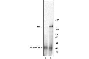 ZEB1 antibody (pAb) tested by Immunoprecipitation. (ZEB1 antibody  (N-Term))