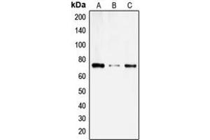 Western Blotting (WB) image for anti-Solute Carrier Family 6 (Amino Acid Transporter), Member 14 (Slc6a14) (C-Term) antibody (ABIN7297906)
