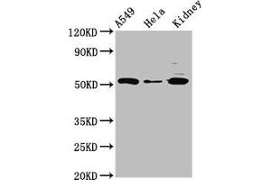Western Blot Positive WB detected in: A549 whole cell lysate, Hela whole cell lysate, Rat kidney tissue All lanes: FICD antibody at 3 μg/mL Secondary Goat polyclonal to rabbit IgG at 1/50000 dilution Predicted band size: 52 kDa Observed band size: 52 kDa (FICD antibody  (AA 63-185))