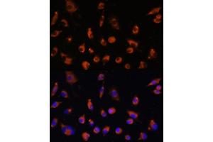 Immunofluorescence analysis of L929 cells using TMEM25 antibody (ABIN7270963) at dilution of 1:100. (TMEM25 antibody  (AA 223-322))