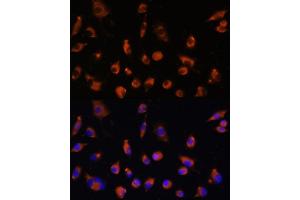Immunofluorescence analysis of L929 cells using TMEM25 antibody (ABIN7270963) at dilution of 1:100. (TMEM25 antibody  (AA 223-322))