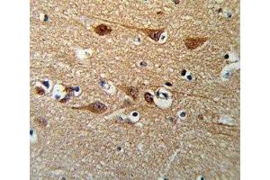 Immunohistochemistry (IHC) image for anti-SMAD, Mothers Against DPP Homolog 3 (SMAD3) (AA 186-215) antibody (ABIN3032621)