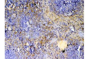 IHC analysis of ICOS using anti-ICOS antibody . (ICOS antibody  (AA 21-200))