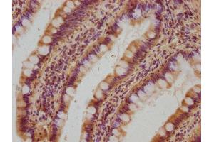 IHC image of ABIN7162407 diluted at 1:100 and staining in paraffin-embedded human small intestine tissue performed on a Leica BondTM system. (OSBPL7 antibody  (AA 1-249))