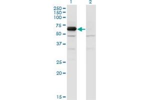 Western Blot analysis of DPYSL4 expression in transfected 293T cell line by DPYSL4 monoclonal antibody (M01), clone 1F5.