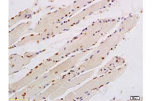 Formalin-fixed and paraffin embedded human smooth muscle labeled with Anti-KLF6/PAC1 Polyclonal Antibody, Unconjugated (ABIN685927) at 1:200 followed by conjugation to the secondary antibody and DAB staining. (KLF6 antibody)