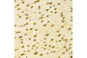 Immunohistochemistry of paraffin-embedded rat brain using HDGF Antibody (ABIN1876535) at dilution of 1:100 (40x lens). (HDGF antibody)