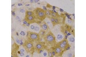 Immunohistochemistry of paraffin-embedded Human liver, using NBR1 Polyclonal Antibody (NBR1 antibody)