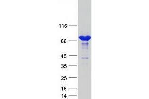 Validation with Western Blot