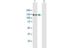 Western Blot analysis of ZFYVE16 expression in transfected 293T cell line by ZFYVE16 MaxPab polyclonal antibody. (ZFYVE16 antibody  (AA 1-809))