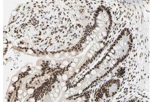ABIN6266854 at 1/100 staining human colon tissue sections by IHC-P. (PRKDC antibody  (Internal Region))