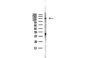 Western blot analysis of lysates from PC12 cells(LPS,4h treatment), using Phospho-EZH2 (Ser21) Antibody at 1/1000 dilution.