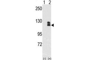 Western Blotting (WB) image for anti-EPH Receptor B2 (EPHB2) antibody (ABIN3003348) (EPH Receptor B2 antibody)