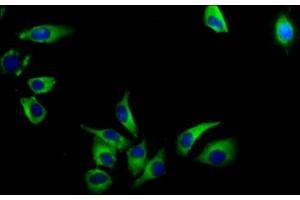 Immunofluorescence staining of A549 cells with ABIN7175408 at 1:133, counter-stained with DAPI.