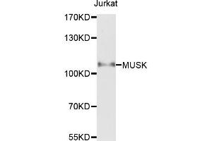 Western blot analysis of extracts of Jurkat cells，using MUSK antibody.