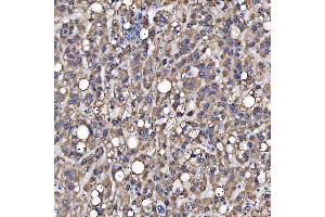 IHC analysis of SARS2 using anti-SARS2 antibody (ABIN7601804). (SARS2 antibody  (AA 46-518))