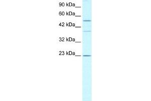 WB Suggested Anti-ZNFN1A1 Antibody Titration:  0. (IKZF1 antibody  (Middle Region))