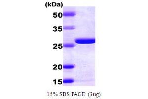 SDS-PAGE (SDS) image for Adenylate Kinase 2 (AK2) (AA 1-239) protein (His tag) (ABIN666627)