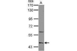 WB Image Sample (30 ug of whole cell lysate) A: U87-MG 7. (ASIC1 antibody  (Center))