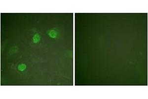 Immunofluorescence analysis of HeLa cells, using GATA3 (Ab-308) Antibody. (GATA3 antibody  (AA 274-323))