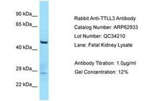 TTLL3 anticorps  (AA 812-861)