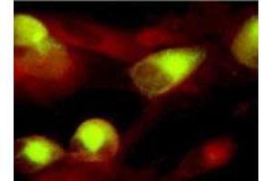 Immunofluorescence (IF) image for anti-CMV gB antibody (ABIN265541)