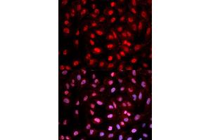 Immunofluorescence (IF) image for anti-DNA (Cytosine-5)-Methyltransferase 1 (DNMT1) (pTyr399) antibody (ABIN1870099) (DNMT1 antibody  (pTyr399))