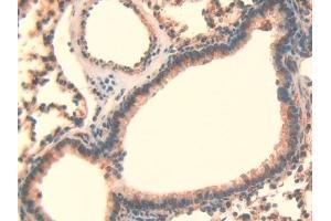 Detection of LOXL3 in Mouse Lung Tissue using Polyclonal Antibody to Lysyl Oxidase Like Protein 3 (LOXL3) (LOXL3 antibody  (AA 509-712))