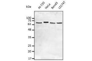 Anti-LMNA Ab at 1/2,500 dilution, lysates at 50 µg per Iane, rabbit polyclinal to goat lgG (HRP) at  1/10,000 dilution, (Lamin A/C antibody  (C-Term))