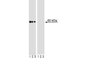 Western blot analysis of AKT (pS473) in human T leukemia. (AKT1 antibody  (pSer473))